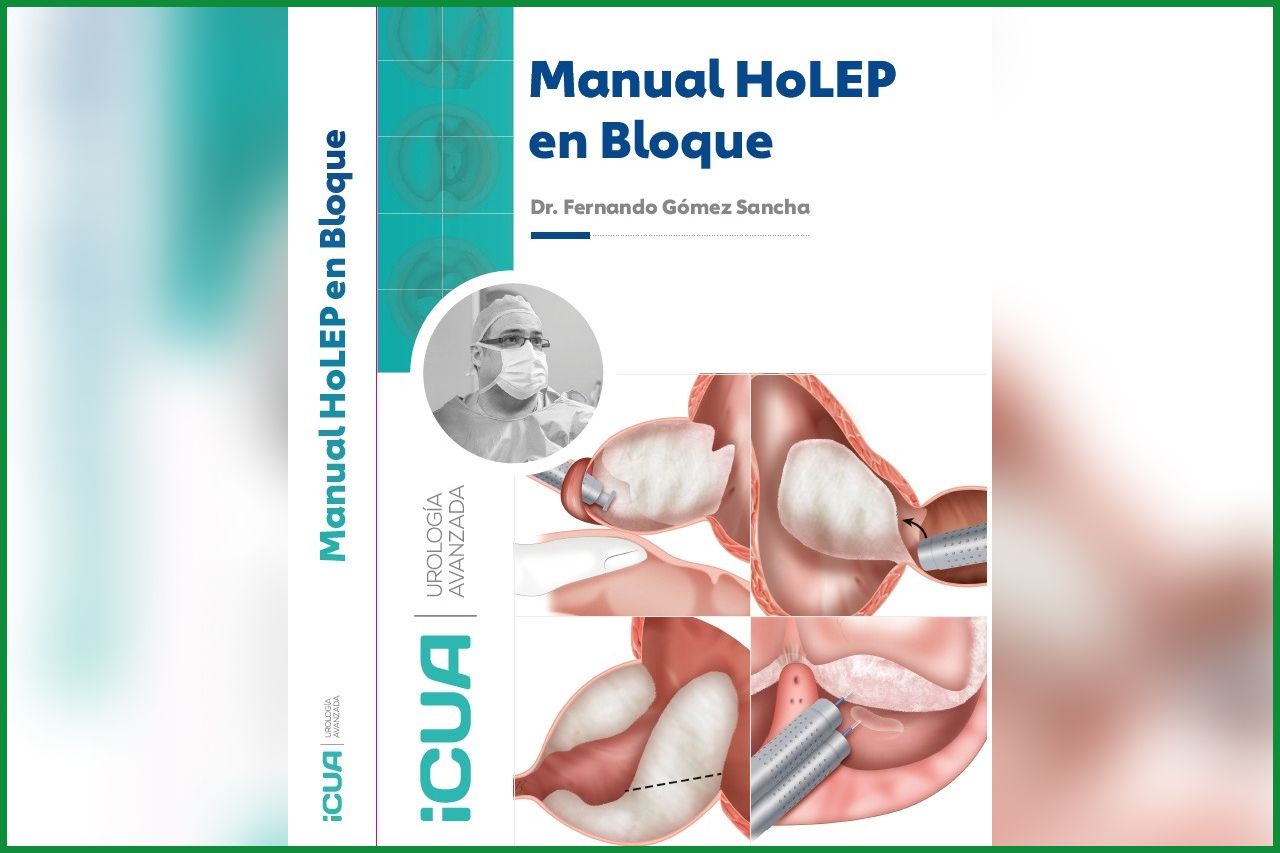 Italfarmaco edita un manual de urología para la enucleación prostática con láser (HoLEP)